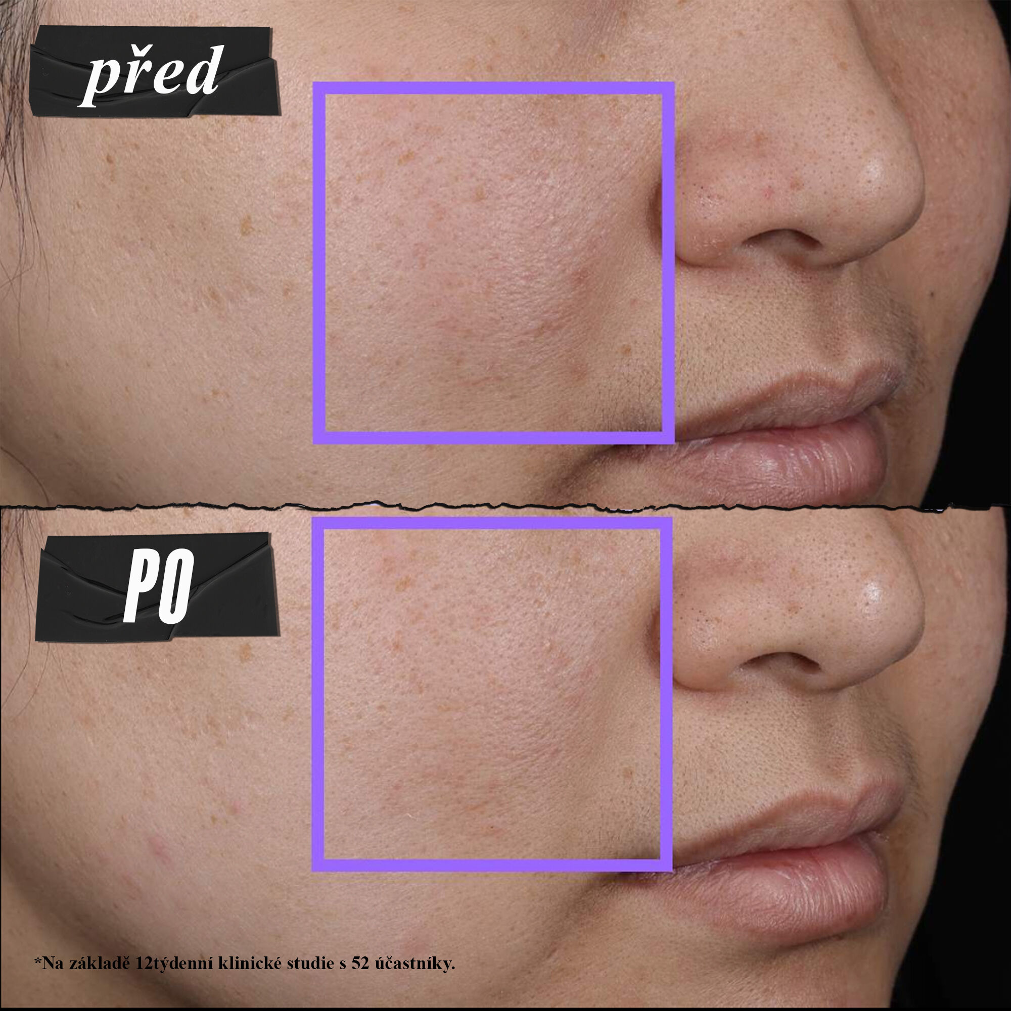 Clearly Corrective™ Clarity-Activating Soothing Emulsion