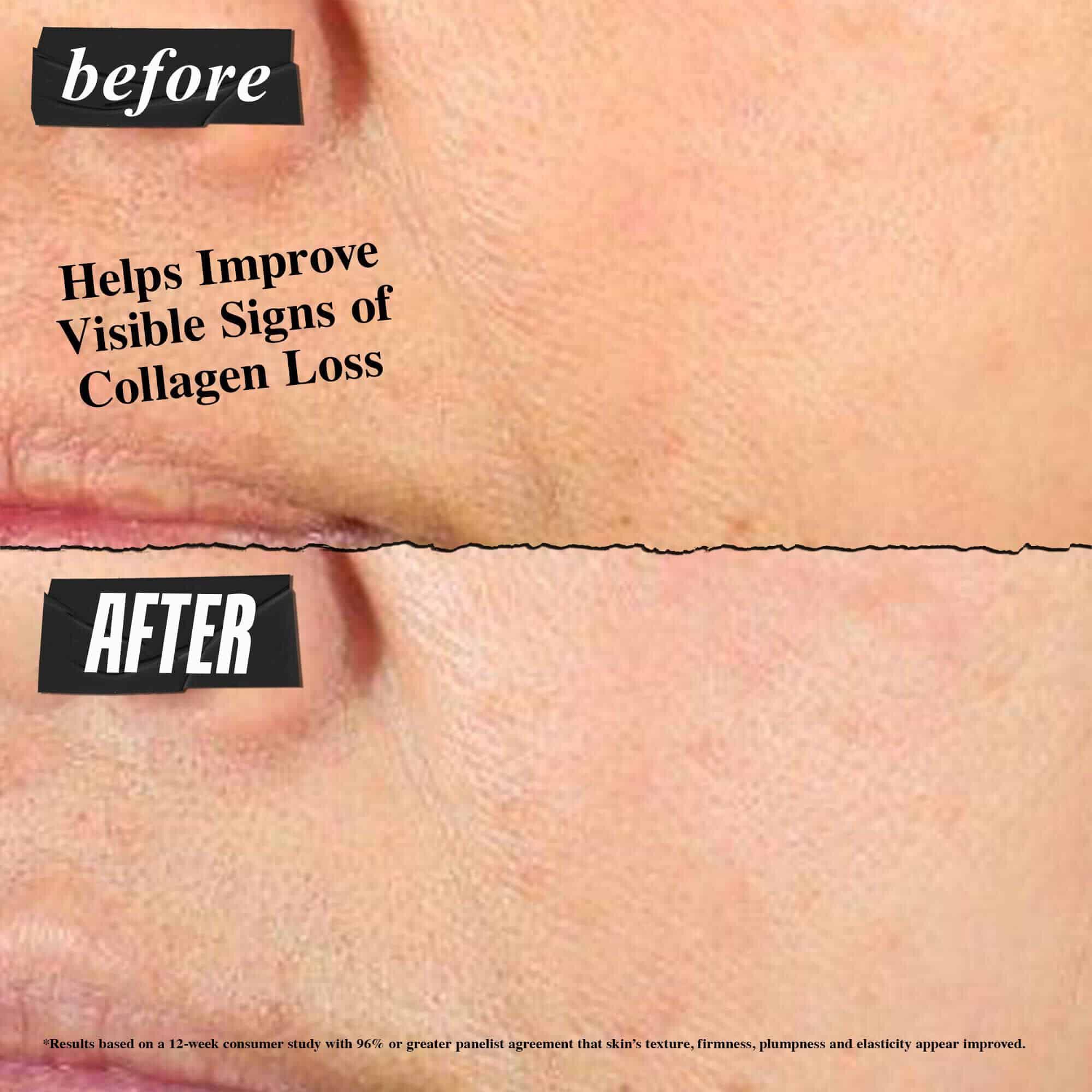 Fotografie „Před a Po“ – krem Kiehl's Super Multi-Corrective Cream pomaha zlepšit viditelne znamky ubytku kolagenu