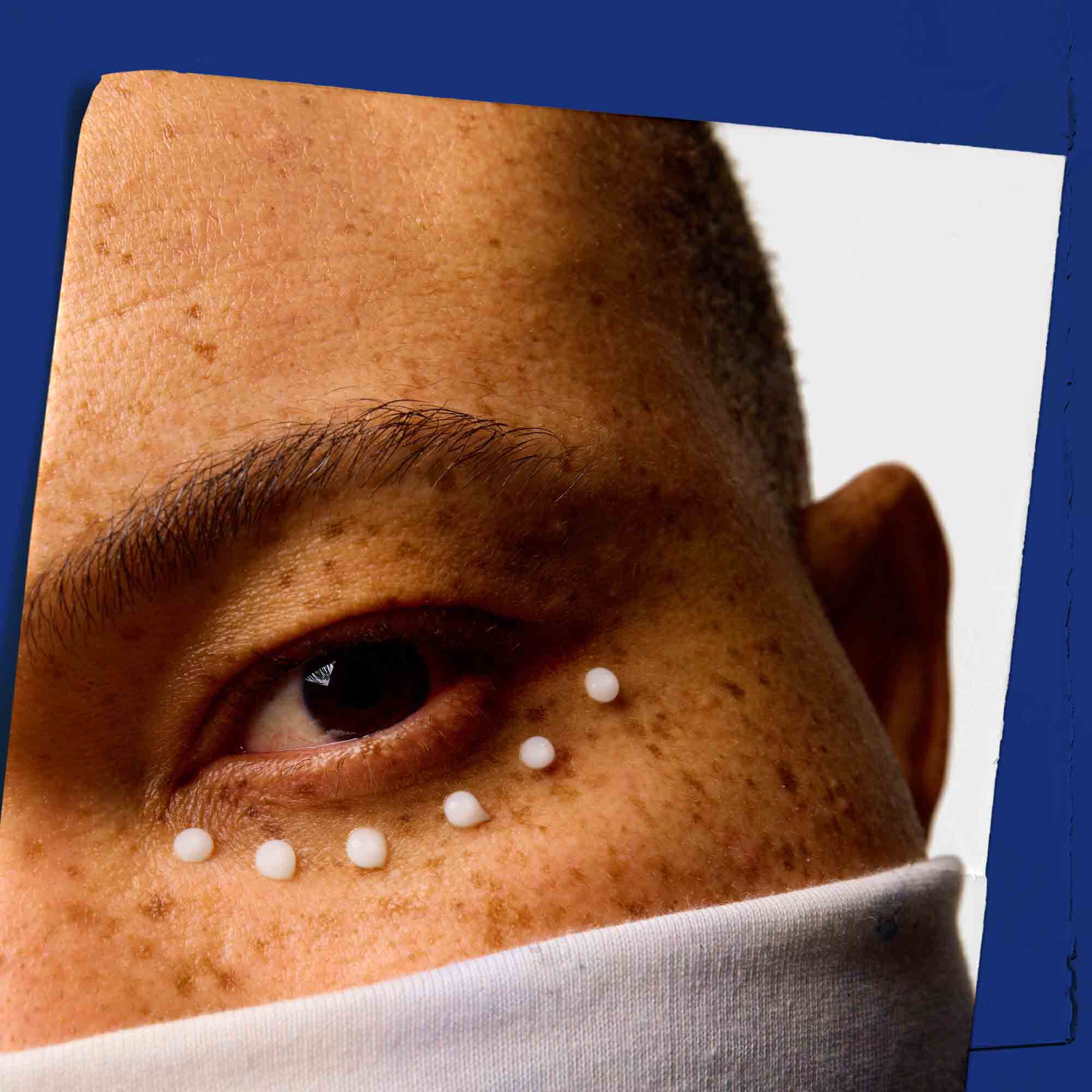 Detail pokožky kolem oči s nanesenym Facial Fuel Eye Fuel.