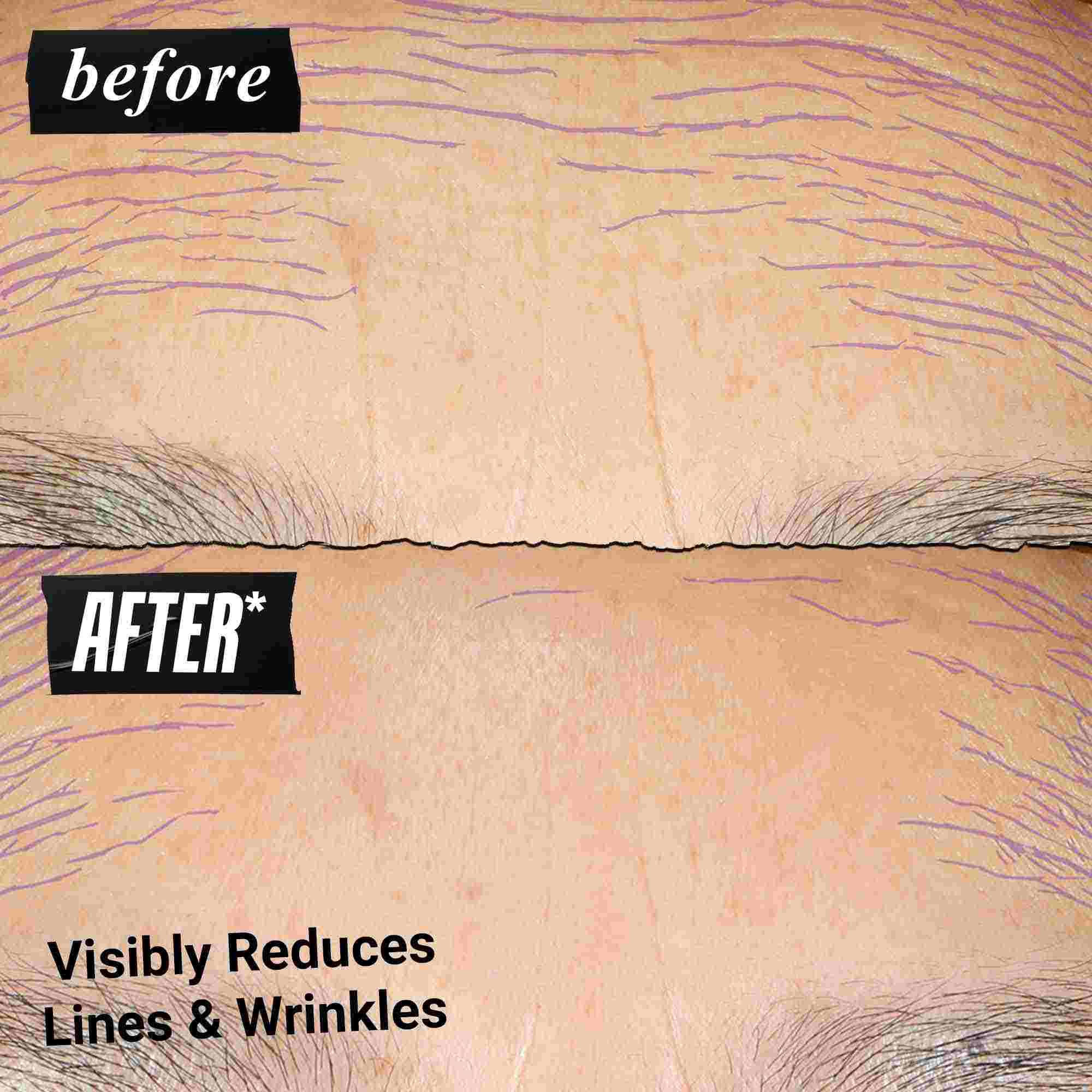 Fotografie „Před a Po“ – Kiehl's Retinol Skin Renewing Daily Microdose pomaha zlepšit ton a texturu pleti