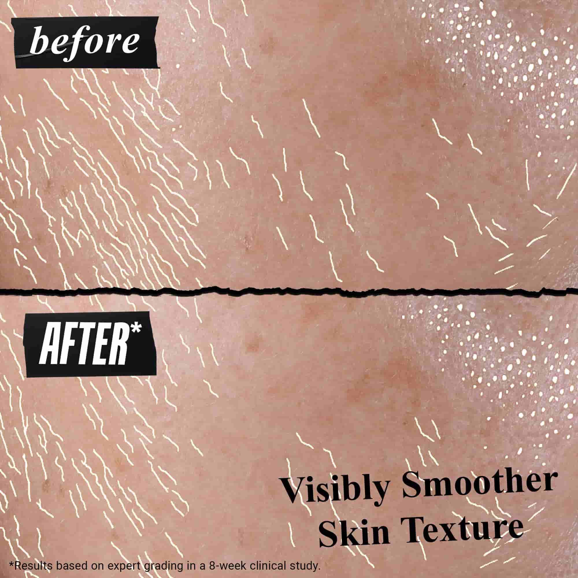 Vysledky před a po použiti Better Screen UV Serum na pleti
