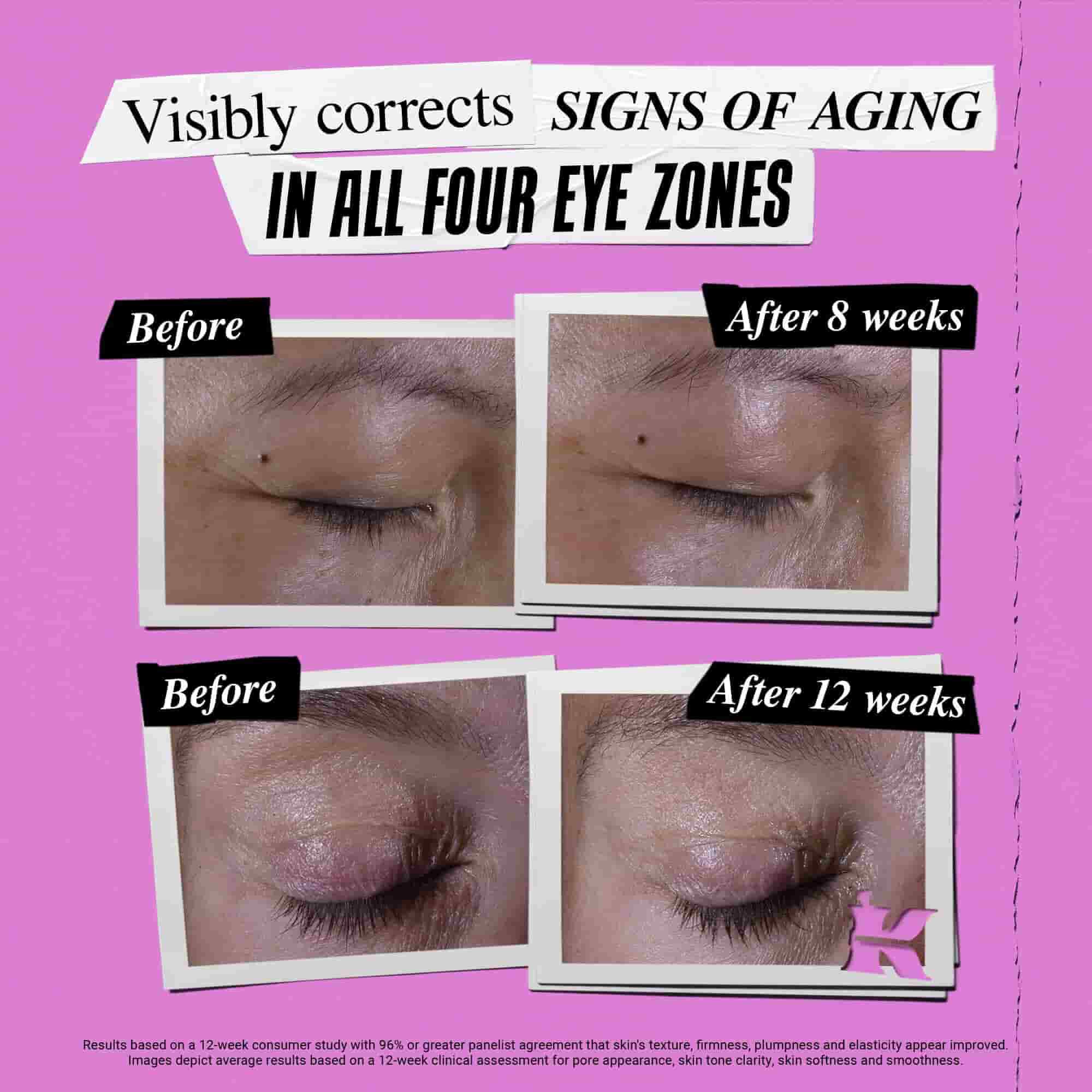Fotografie „Před a Po“ – peče Kiehl's Super Multi-Corrective Eye Zone Treatment koriguje znamky starnuti