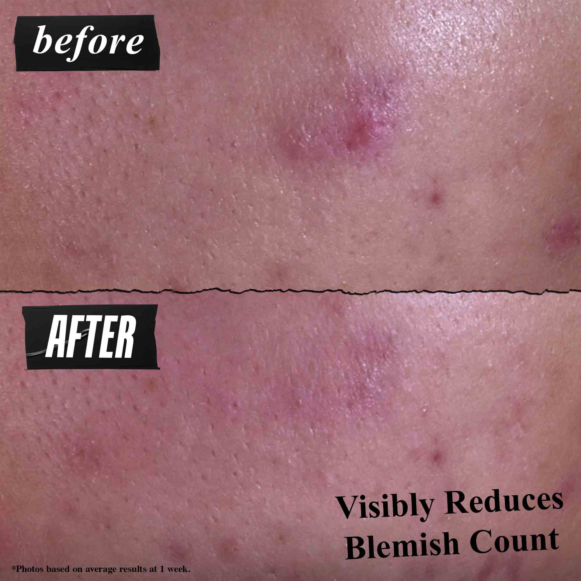 Gently Effective Blemish-Targeting Cleansing Paste