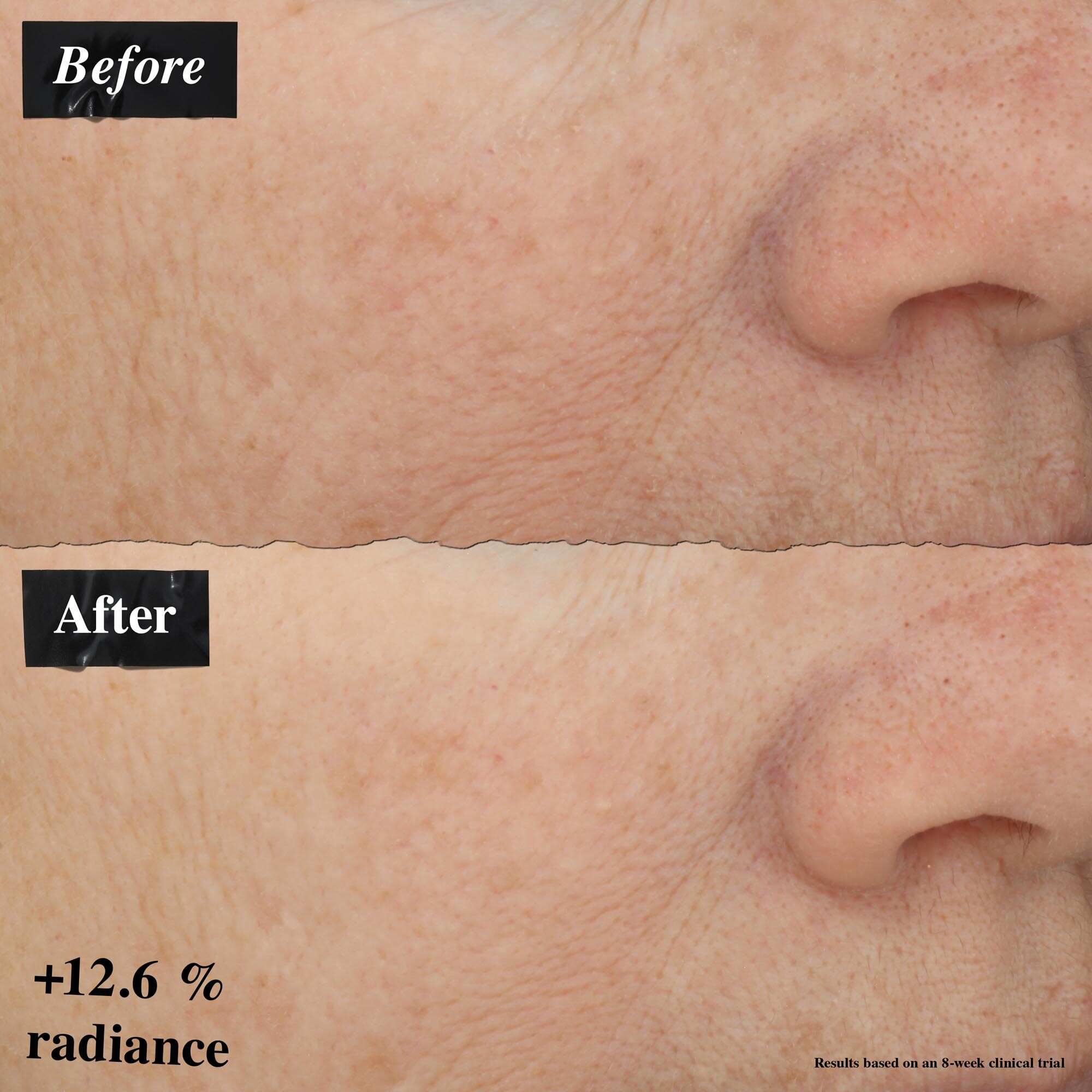 Srovnani obrazků před a po ukazujici zlepšeni zarudnuti pleti po použiti Powerful-Strength Line-Reducing Concentrate.