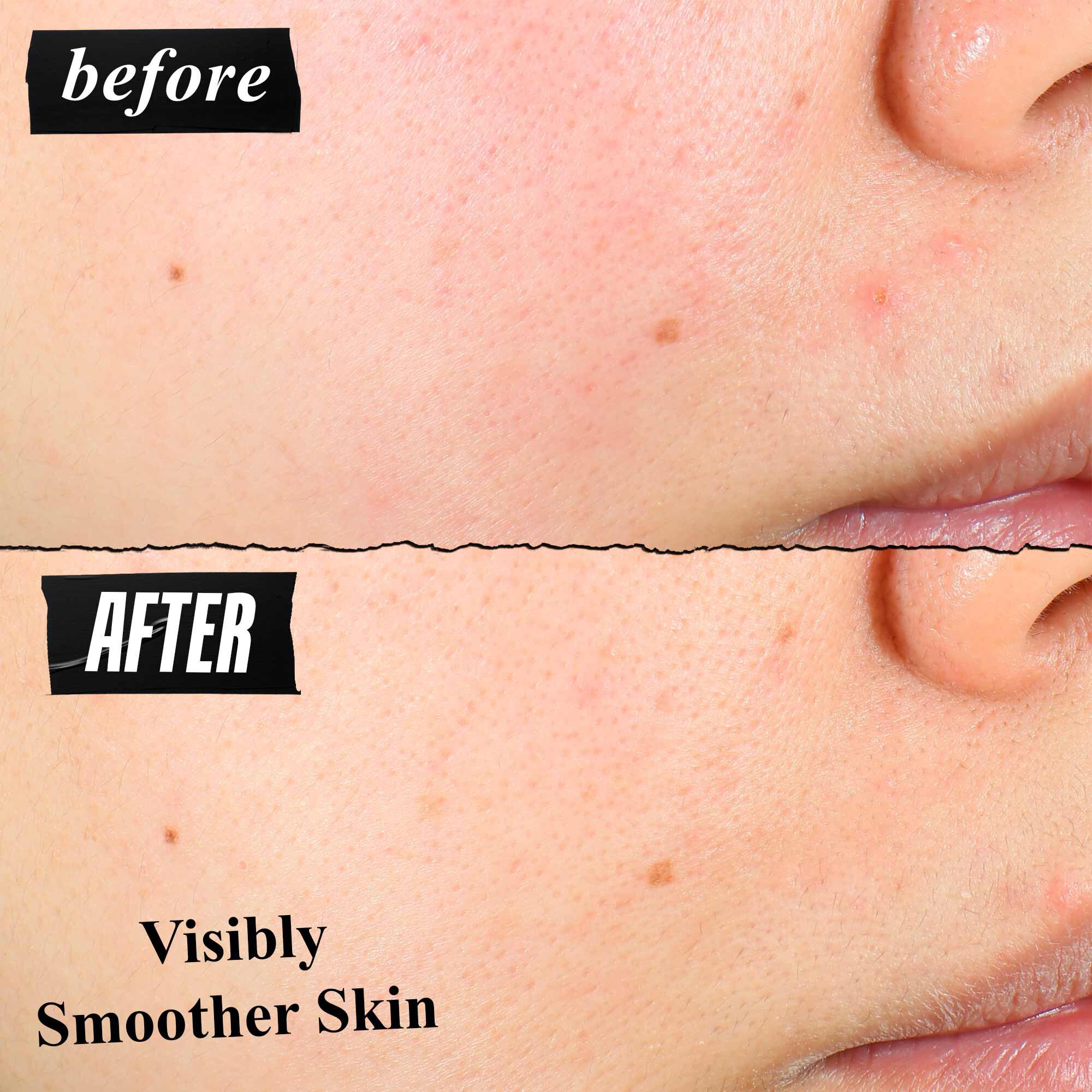 Srovnani textury pleti před a po, ukazujici viditelně hladši pleť po použiti.