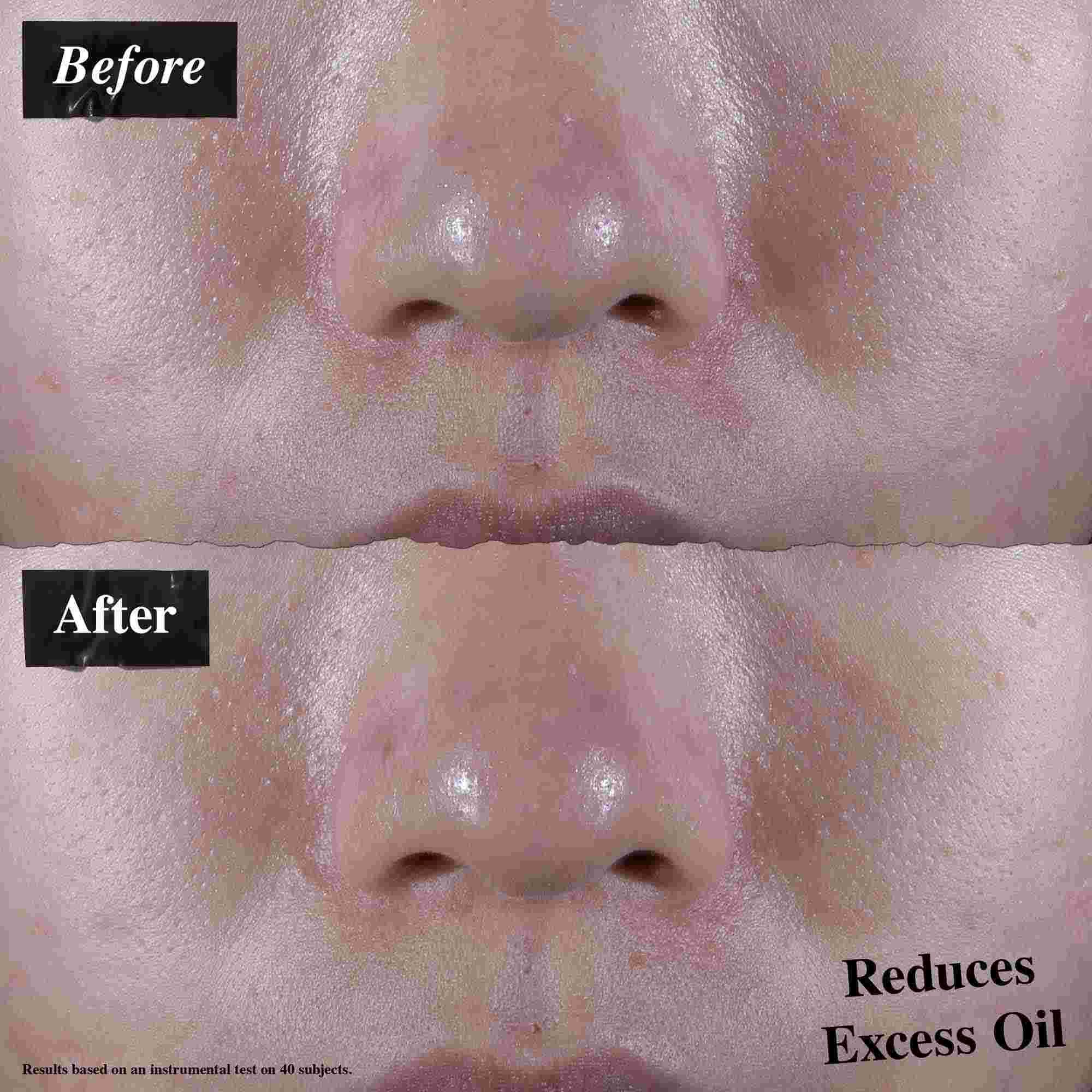 Srovnani před a po ukazujici sniženy přebytečny maz po použiti Ultra Facial Oil-Free Gel Cream.