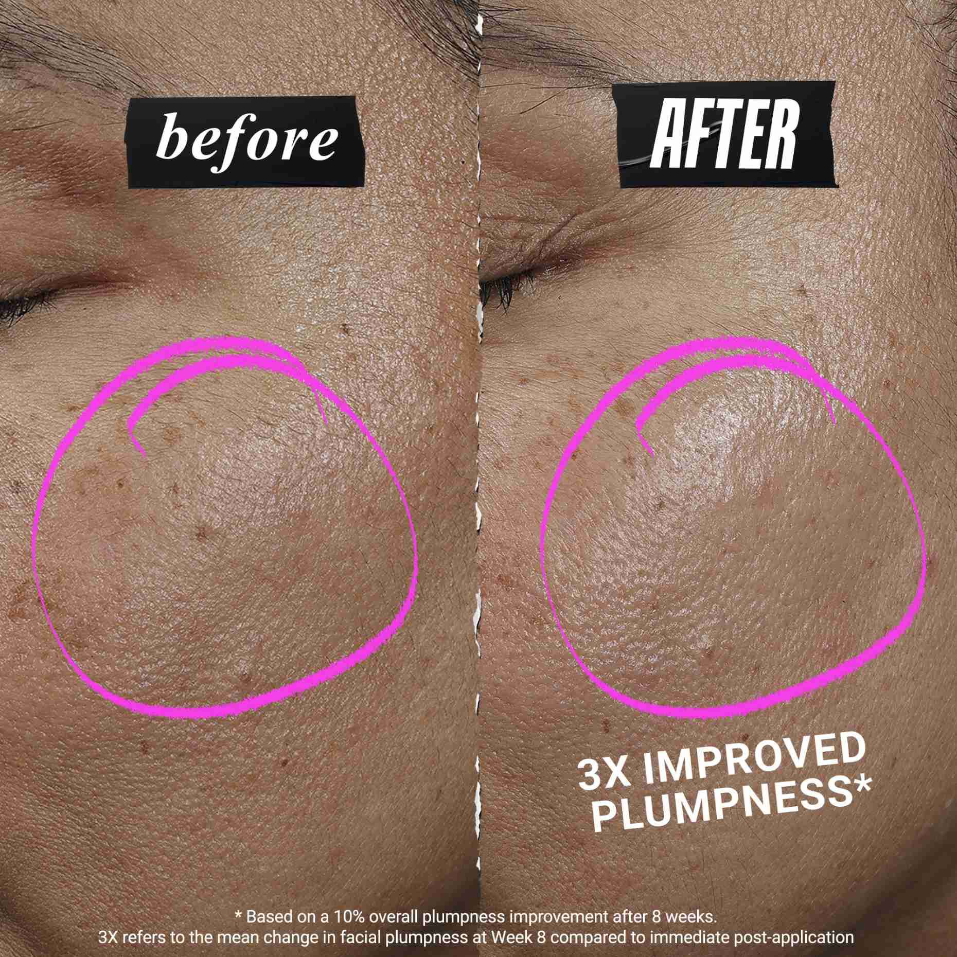 1cc* CollaShot Plump Serum, kolagenove pleťove serum pro vyplněnou a zpevněnou pleť