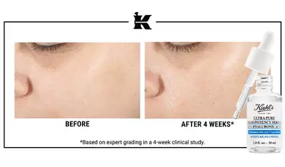 Before and after images showing skin improvement over four weeks, with a dropper bottle of Kiehl's Ultra Pure High-Potency Serum displayed below.