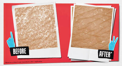 Two photo frames side by side on a red background. The left frame labeled "Before" shows a textured skin surface with fine lines, while the right frame labeled "After" displays a smoother skin surface with fewer visible lines.