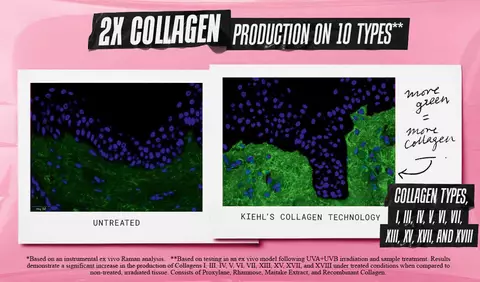 2X Collagen Production on 10 Types