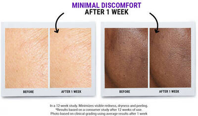 Vedlejši učinky retinolu