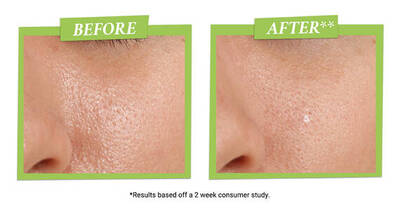Alt text: "Comparison images showing close-ups of skin before and after a treatment, highlighting improved texture and hydration."