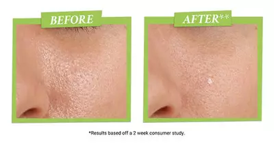 Alt text: "Comparison images showing close-ups of skin before and after a treatment, highlighting improved texture and hydration."
